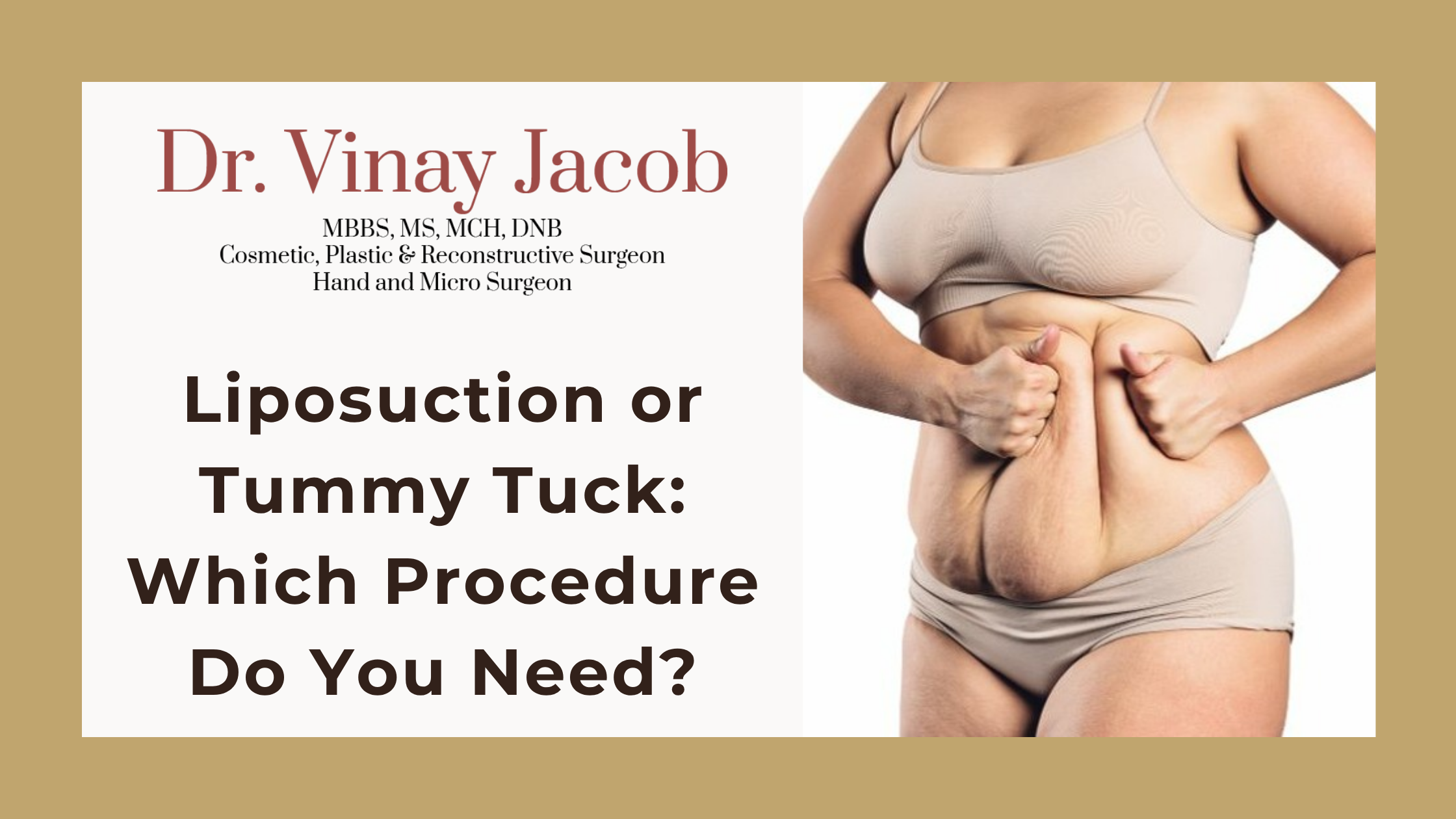 Liposuction or Tummy Tuck: Which Procedure Do You Need?